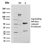 CD61/Integrin 3/Platelet Glycoprotein IIIa (Platelet Marker) Antibody in SDS-PAGE (SDS-PAGE)