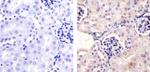 Phospho-PAX2 (Ser393) Antibody in Immunohistochemistry (Paraffin) (IHC (P))