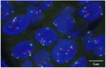 Phospho-EGFR (Tyr1086) Antibody in Immunohistochemistry (IHC)