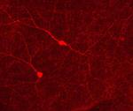 Phospho-Tyrosine Hydroxylase (Ser31) Antibody in Immunocytochemistry (ICC/IF)