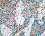 c-Met Antibody in Immunohistochemistry (IHC)