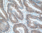 EphB4 Antibody in Immunohistochemistry (IHC)