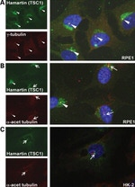 TSC1 Antibody in Immunocytochemistry (ICC/IF)