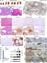 TSC1 Antibody in Immunohistochemistry (IHC)