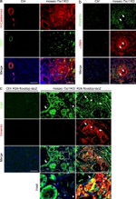 TSC1 Antibody in Immunohistochemistry (IHC)