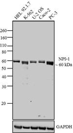 KPNA1 Antibody in Western Blot (WB)