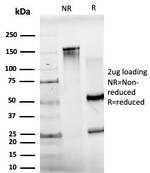 JunB/Transcription Factor JunB Antibody in SDS-PAGE (SDS-PAGE)