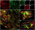 NG2 Antibody in Immunohistochemistry (IHC)