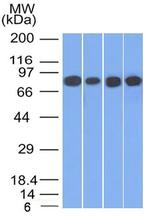 Catenin, gamma (Cardiomyocyte Marker) Antibody in Western Blot (WB)