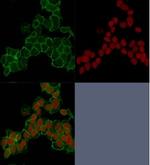 Catenin, gamma (Cardiomyocyte Marker) Antibody in Immunocytochemistry (ICC/IF)