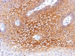 Catenin, gamma Antibody in Immunohistochemistry (Paraffin) (IHC (P))