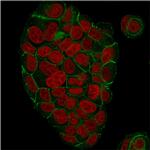 Catenin, gamma Antibody in Immunocytochemistry (ICC/IF)