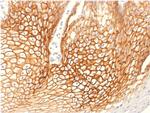 Catenin, gamma Antibody in Immunohistochemistry (Paraffin) (IHC (P))