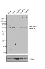 BTRC Antibody in Western Blot (WB)