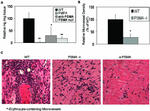 PSMA Antibody in Immunohistochemistry (IHC)