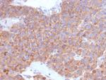 B7-H6/NCR3LG1 (Natural Killer Cell Cytotoxicity Receptor 3 Ligand 1) Antibody in Immunohistochemistry (Paraffin) (IHC (P))