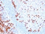 B7-H6/NCR3LG1 (Natural Killer Cell Cytotoxicity Receptor 3 Ligand 1) Antibody in Immunohistochemistry (Paraffin) (IHC (P))