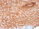 Suprabasin (SBSN) (CALB1) Antibody in Immunohistochemistry (Paraffin) (IHC (P))