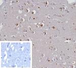 GIRK2 (Interleukin-6)/Interferon beta-2 (Hybridoma Growth Factor) Antibody in Immunohistochemistry (Paraffin) (IHC (P))