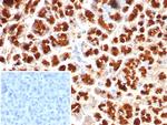 GIRK2 (Interleukin-6)/Interferon beta-2 (Hybridoma Growth Factor) Antibody in Immunohistochemistry (Paraffin) (IHC (P))