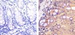 PLK1 Antibody in Immunohistochemistry (Paraffin) (IHC (P))