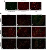 Ubiquilin 2 Antibody in Immunohistochemistry (IHC)