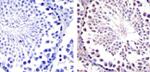 HSP90 beta Antibody in Immunohistochemistry (Paraffin) (IHC (P))