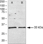 MyD88 Antibody in Western Blot (WB)