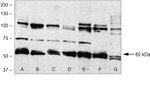 BMPR1A Antibody in Western Blot (WB)