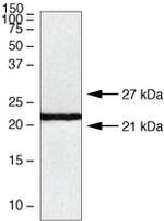 Claudin 10 Antibody in Western Blot (WB)