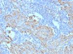 CD117/c-Kit (Marker for Gastrointestinal Stromal Tumors) Antibody in Immunohistochemistry (Paraffin) (IHC (P))