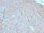 CD117/c-Kit (Marker for Gastrointestinal Stromal Tumors) Antibody in Immunohistochemistry (Paraffin) (IHC (P))