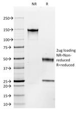 CD117/c-Kit (Marker for Gastrointestinal Stromal Tumors) Antibody in SDS-PAGE (SDS-PAGE)