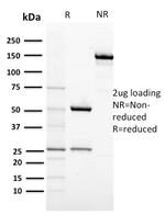 CD117/c-Kit (Marker for Gastrointestinal Stromal Tumors) Antibody in SDS-PAGE (SDS-PAGE)