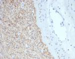 CD117/c-Kit (Marker for Gastrointestinal Stromal Tumors) Antibody in Immunohistochemistry (Paraffin) (IHC (P))