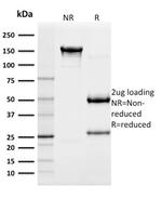 CD117/c-Kit (Marker for Gastrointestinal Stromal Tumors) Antibody in SDS-PAGE (SDS-PAGE)