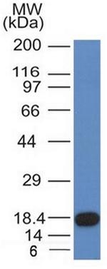 CD117/c-Kit (Marker for Gastrointestinal Stromal Tumors) Antibody in Western Blot (WB)