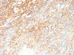 CD117/c-Kit (Marker for Gastrointestinal Stromal Tumors) Antibody in Immunohistochemistry (Paraffin) (IHC (P))