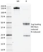 CD117/c-Kit (Marker for Gastrointestinal Stromal Tumors) Antibody in SDS-PAGE (SDS-PAGE)