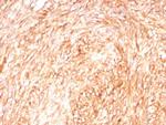 CD117/c-Kit (Marker for Gastrointestinal Stromal Tumors) Antibody in Immunohistochemistry (Paraffin) (IHC (P))