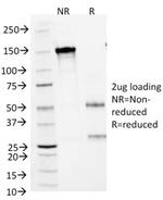 Arginase1 (Hepatocellular Carcinoma Marker) Antibody in SDS-PAGE (SDS-PAGE)