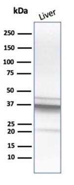 Arginase1 (Hepatocellular Carcinoma Marker) Antibody in Western Blot (WB)