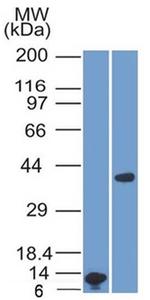 Arginase1 (Hepatocellular Carcinoma Marker) Antibody in Western Blot (WB)