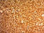 Arginase1 (Hepatocellular Carcinoma Marker) Antibody in Immunohistochemistry (Paraffin) (IHC (P))