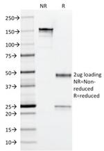 Arginase1 (Hepatocellular Carcinoma Marker) Antibody in SDS-PAGE (SDS-PAGE)