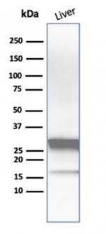 Arginase1 (Hepatocellular Carcinoma Marker) Antibody in Western Blot (WB)