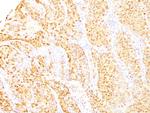 Arginase 1 (Hepatocellular Carcinoma Marker) Antibody in Immunohistochemistry (Paraffin) (IHC (P))