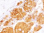 Arginase 1 (Hepatocellular Carcinoma Marker) Antibody in Immunohistochemistry (Paraffin) (IHC (P))