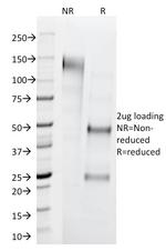 Cytokeratin 1 (Suprabasal Keratinocyte Marker) Antibody in SDS-PAGE (SDS-PAGE)