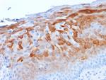 Cytokeratin 1 (Suprabasal Keratinocyte Marker) Antibody in Immunohistochemistry (Paraffin) (IHC (P))